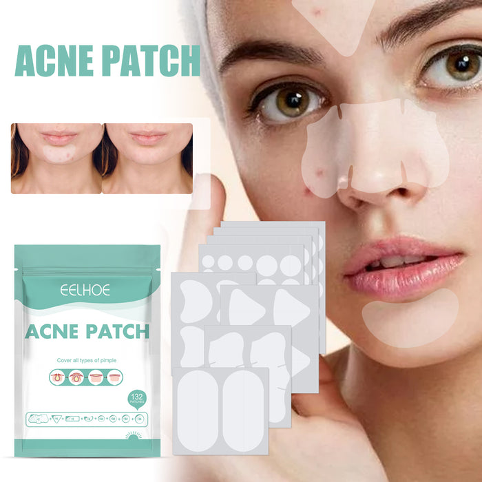 Acne Relief Pimple Patches – Gentle Hydrocolloid Spot & Area Mask Set